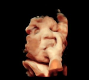 3d/4d/5d ultrasound